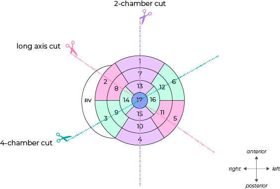 chronic lung disease diagram